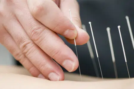 Agopuntura e depressione: nuove frontiere di trattamento all’Aou Senese
