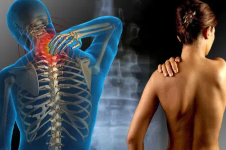 Per la diagnosi e cura della fibromialgia sei centri specializzati in Toscana