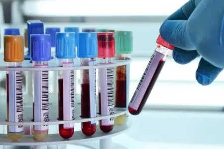 Provette prelievo per analisi del sangue
