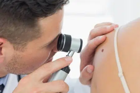 L’Asl Tse a fianco dei cittadini per prevenzione melanoma e tumori della pelle Controllo nevi, medico e paziente