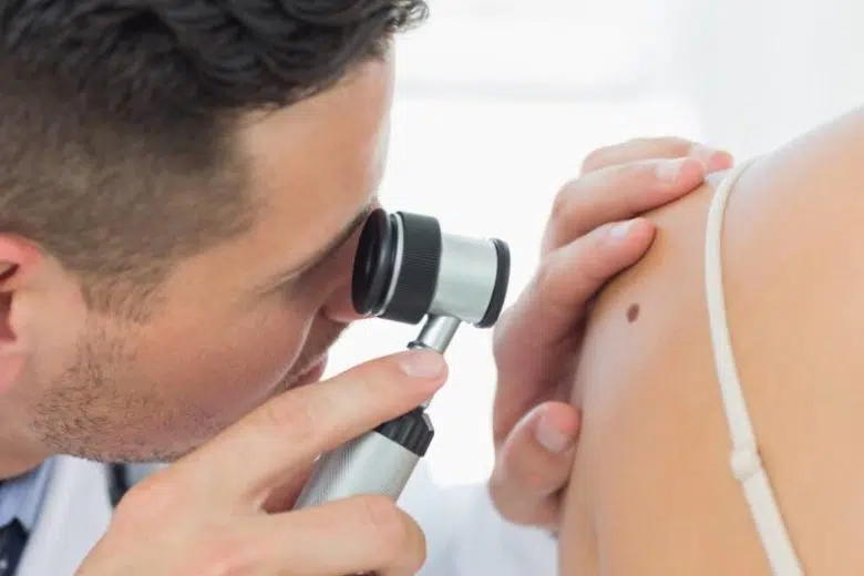 L’Asl Tse a fianco dei cittadini per prevenzione melanoma e tumori della pelle Controllo nevi, medico e paziente