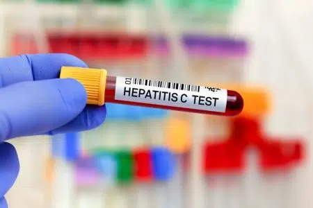 Epatite C: al via i test negli ambulatori dei medici e nelle farmacie della Toscana Epatite C, test, provetta