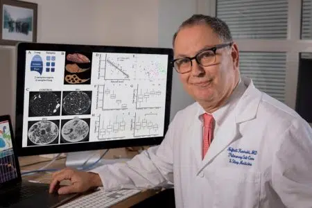Fibrosi polmonare, all’Aou Senese seminario con il professor Naftali Kaminski Naftali Kaminski