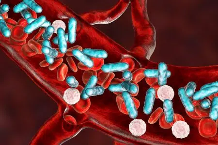 World Sepsis Day: Siena ospita il convegno toscano sulla sepsi Sepsi, batteri nel sangue