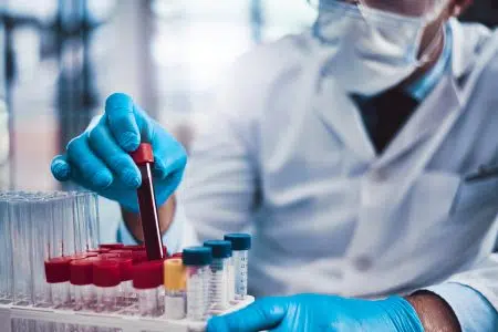 Laboratori analisi Asl Toscana sud est: nel 2024 processati 16 milioni di test Laboratorio analisi