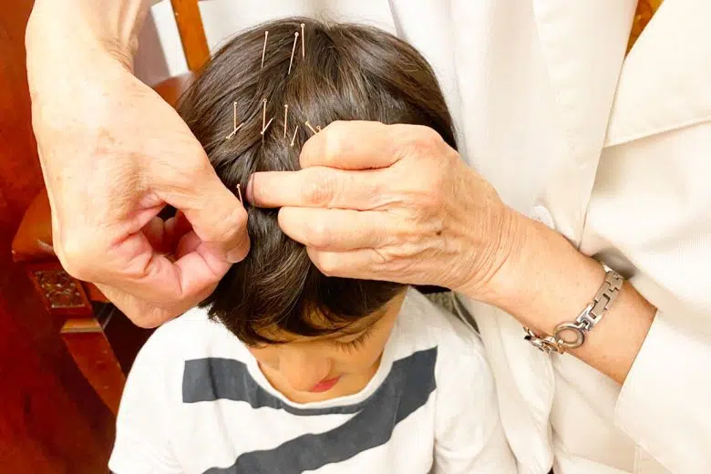 Siena capitale della Neuro-agopuntura Neuro-agopuntura, bambino