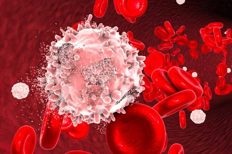 L’orizzonte terapeutico delle leucemie acute, convegno all’Aous Leucemia, vista al microscopio