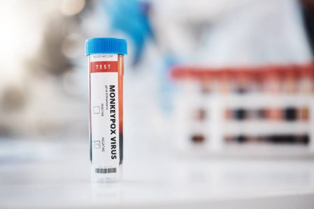 Mpox, il Biotecnopolo di Siena punta sulla ricerca per fermare il virus